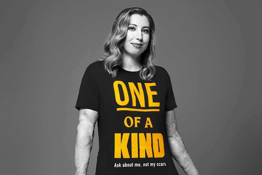 Image of a woman called Cat, wearing a t-shirt saying ‘One of a kind. Ask about me, not my scars.”